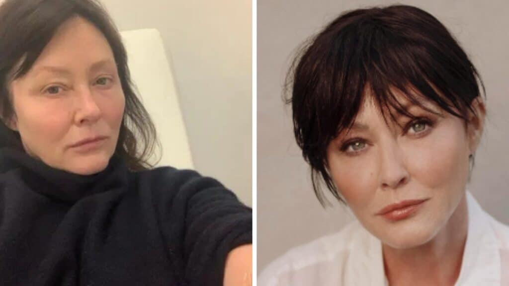 Shannen Doherty speaks out about chemotherapy